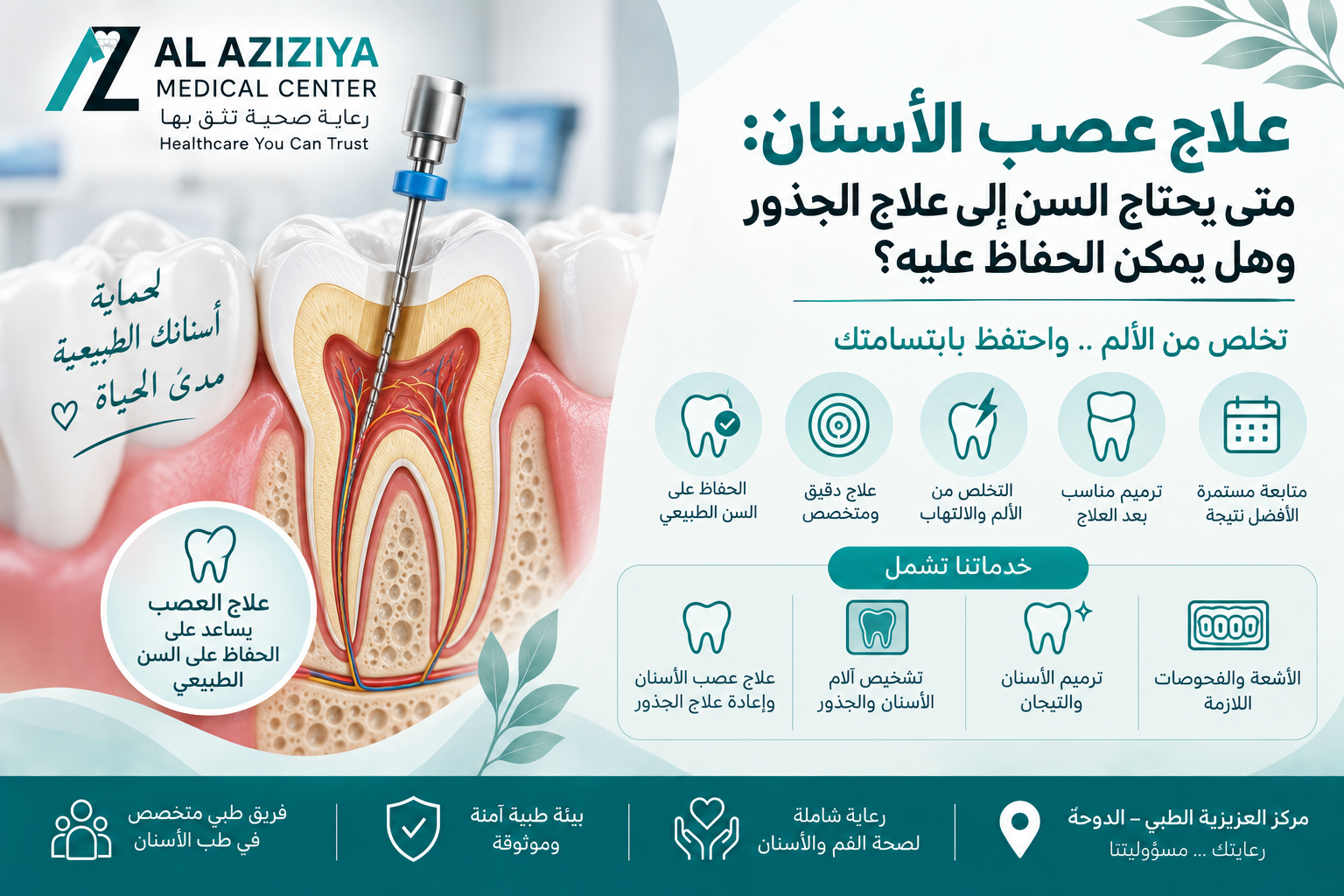 
علاج عصب الأسنان وعلاج الجذور والحفاظ على السن الطبيعي في قسم طب الأسنان بمركز العزيزية الطبي في الدوحة
